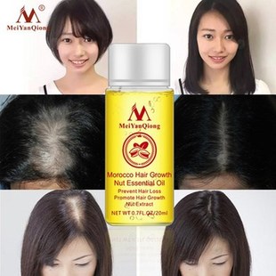 推荐 anti Essence Loss Growth Hair fast Liq Oil Products