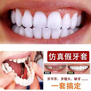 推荐 牙套可吃饭神器缺牙断牙美白牙齿牙不齐牙缝大成人全口假牙仿