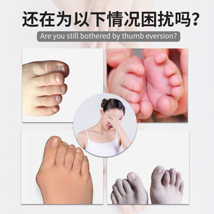 儿童拇指外翻宝宝大脚趾矫正器大脚骨纠正固定带男女可穿鞋 分趾器