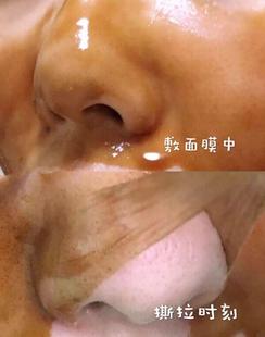 手撕毛拉面膜去黑头拉斯面拉膜可撕鼻螨贴撒脸上虫吸出全脸收PST