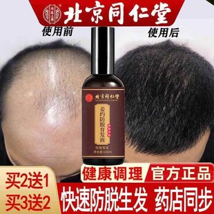 北京同仁堂防脱发育发液生发增发密发际线秃顶男女头发快速增长液