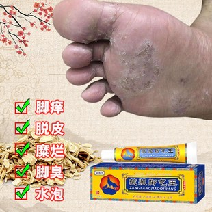 厂家汗脚脚臭脚痒脚趾缝开裂溃烂足藓水泡型真菌感染反复专用软膏
