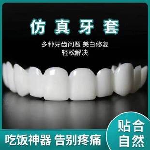 临时假牙牙套吃饭神器门牙遮牙套缺牙假牙套牙仿真牙齿牙套